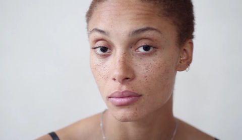 吃瓜雀斑女孩国外,独特魅力与多元审美